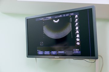 Фото экрана аппарата для ультразвукового исследования