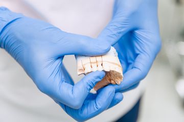 Изображение зубного протеза в руках стоматолога
